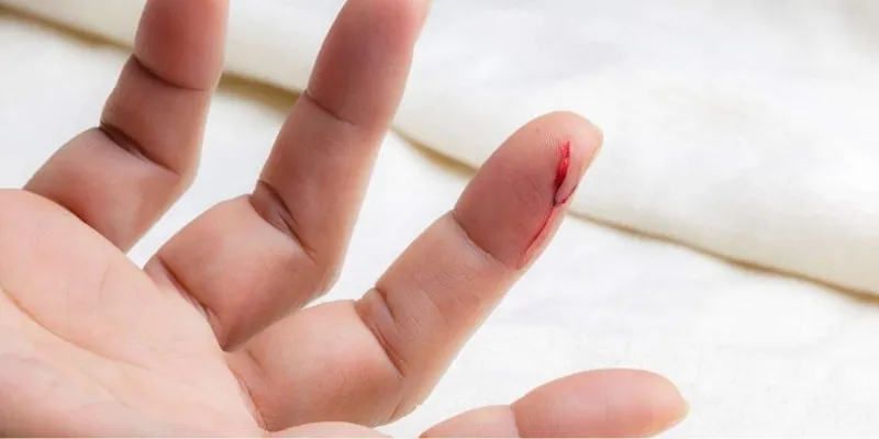 Nằm mơ thấy máu chảy có đáng sợ? Con số may mắn ẩn sau giấc mơ 2 Giấc mơ thấy mất nhiều máu