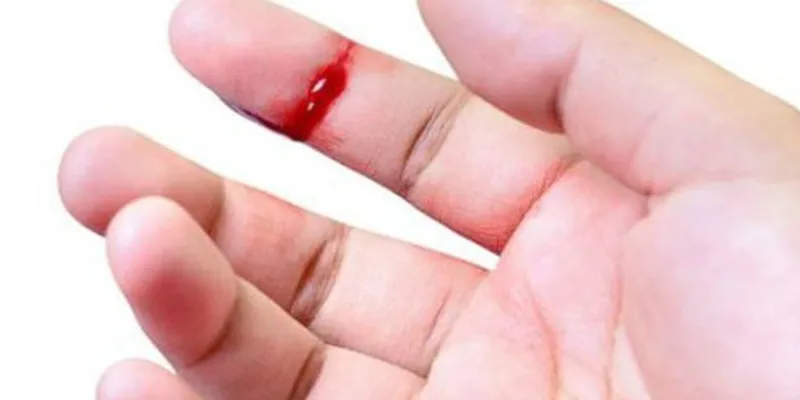 Nằm mơ thấy máu chảy có đáng sợ? Con số may mắn ẩn sau giấc mơ 3 Nằm mơ thấy máu chảy nhưng không đau